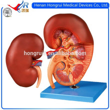 ISO Anatomisches menschliches Nierenmodell